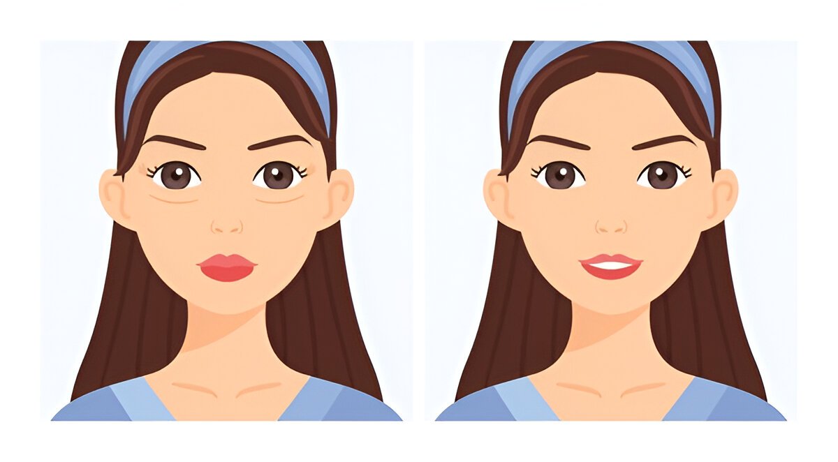 Как убрать мешки под глазами: полный гид для достижения идеального внешнего вида