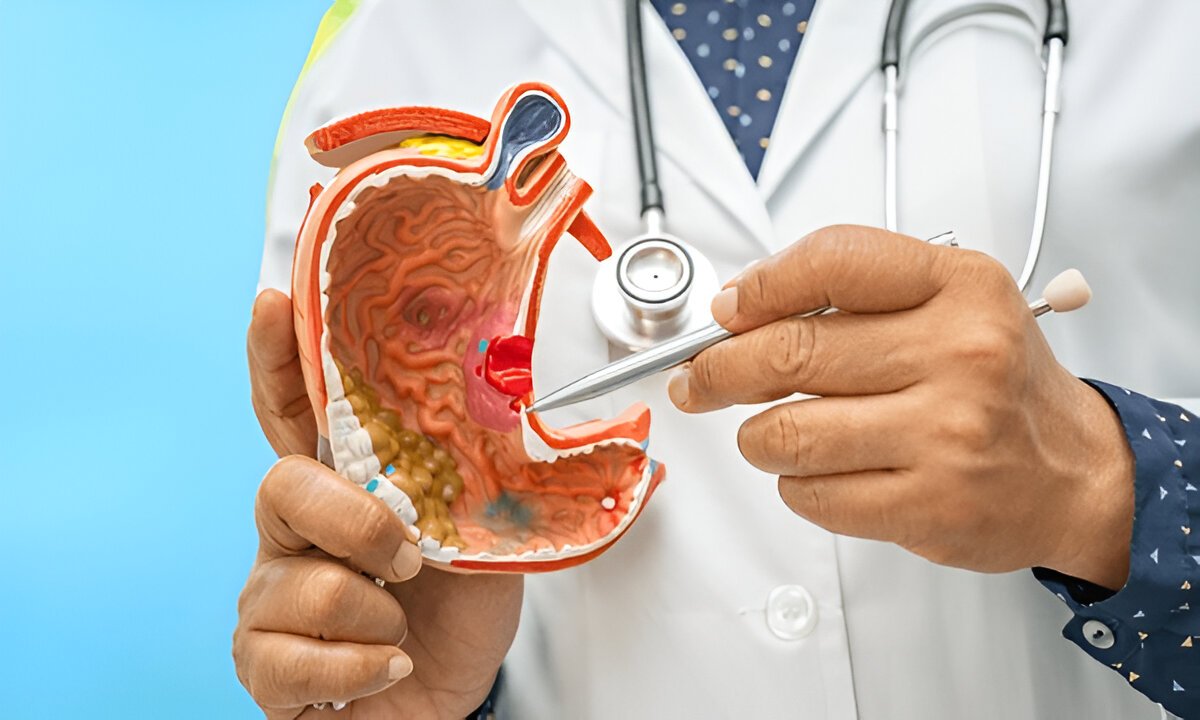 Что такое гастрит и какие основные причины его возникновения и симптомы?