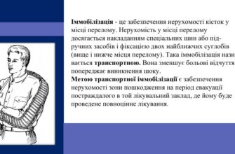 Іммобілізація це: що потрібно знати про процес та його важливість