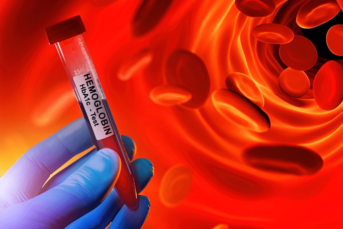 Как поднять гемоглобин за 3 дня в домашних условиях и какие продукты помогут в этом?