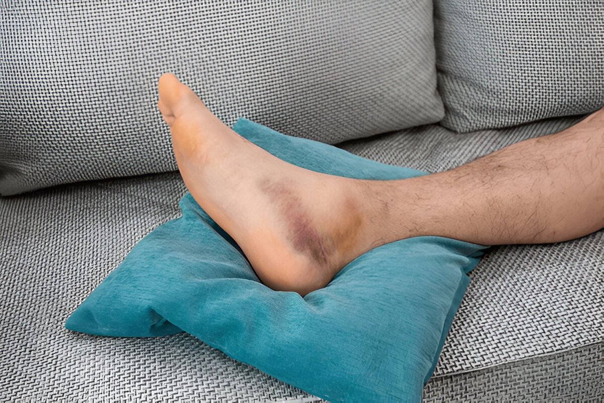 Как снять отек ног в домашних условиях: эффективные методы и советы