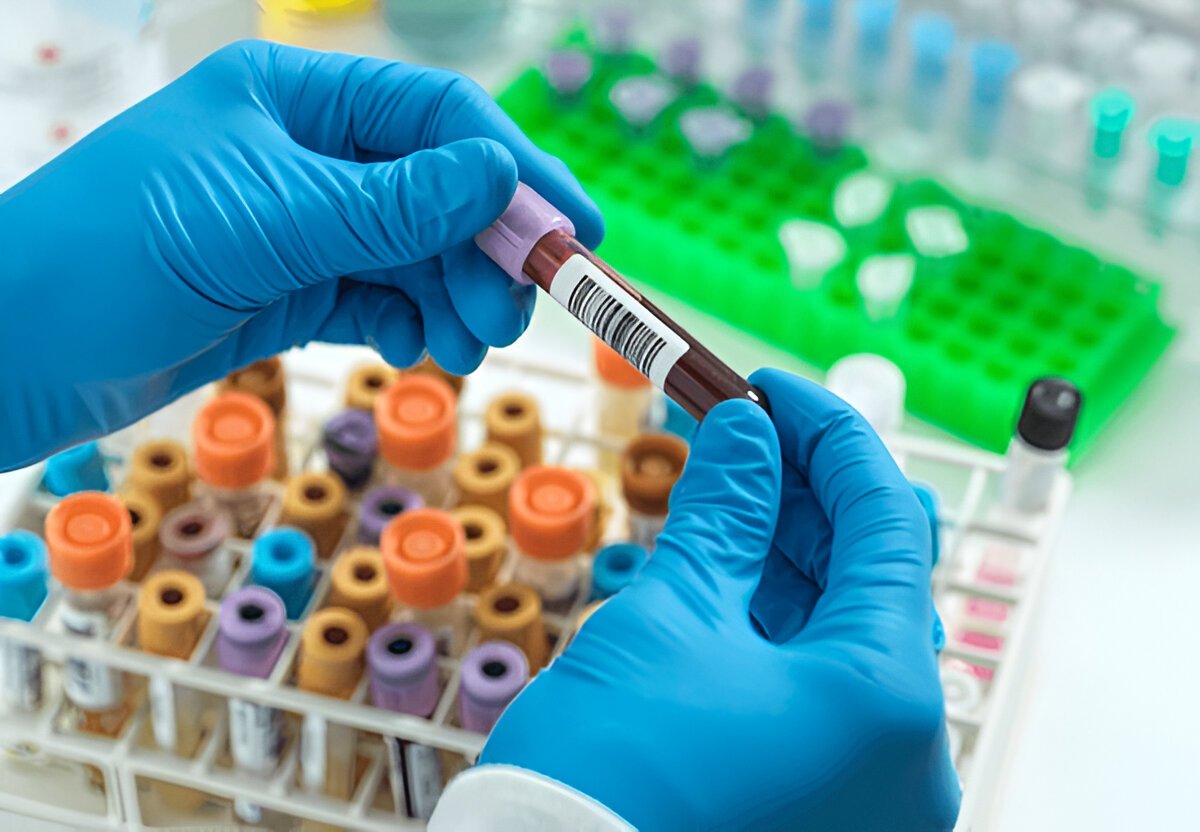 Как понять, что у тебя ВИЧ