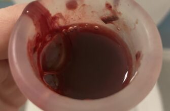 Що таке менструація: основи жіночого циклу і його особливості