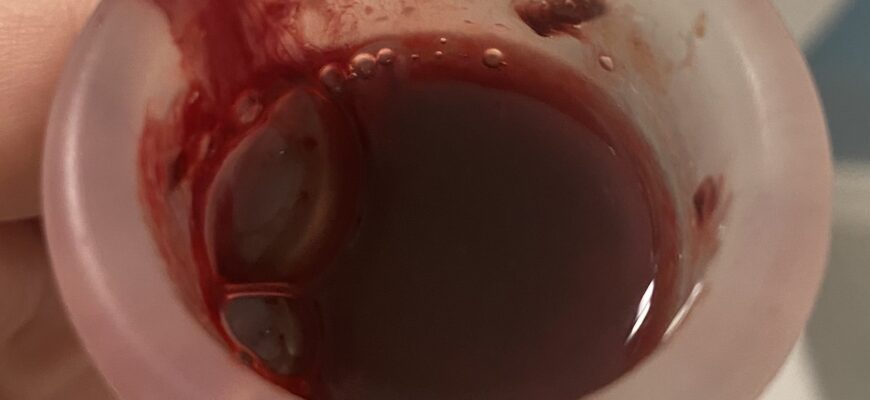 Що таке менструація: основи жіночого циклу і його особливості