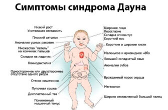 Що таке синдром Дауна: визначення, причини та особливості розвитку