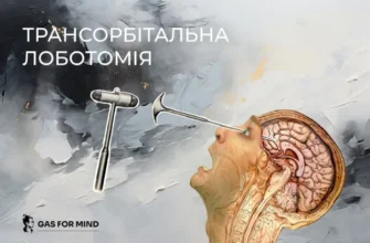 Що таке лоботомія: значення, історія та наслідки процедури